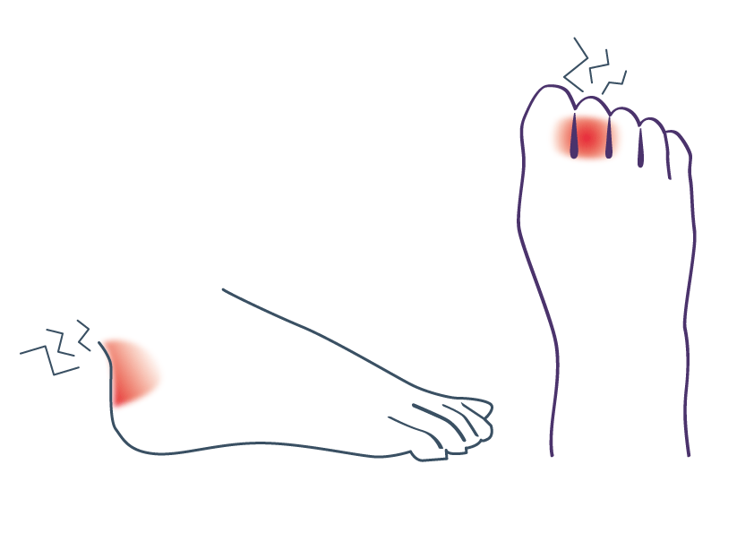 かかとや指がヒリヒリ痛い!原因別の靴ずれ防止方法!